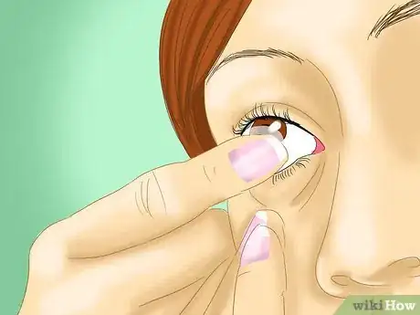 Image titled Determine if You Are Overwearing Your Contact Lenses Step 5