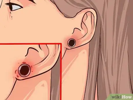 Image titled Pick Earrings when You Get Your Ears Pierced Step 12