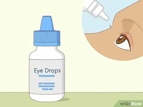 Image titled Get Rid of Puffy Eyelids Step 3