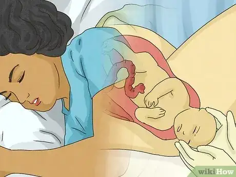 Image titled What Do Pregnancy Dreams Mean Step 4