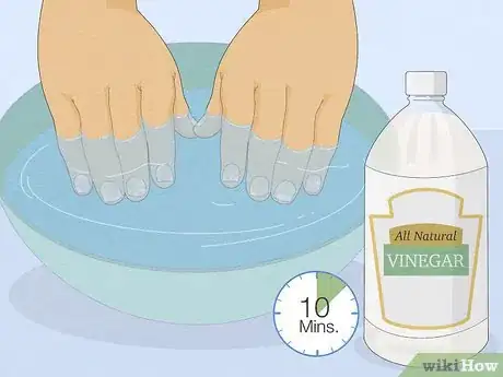 Image titled Get Rid of White Spots on Your Nails Step 3