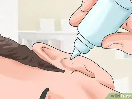 Image titled Remove Wet Wax from Infected Ears Step 2