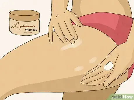 Image titled Get Rid of Stretch Marks Step 6