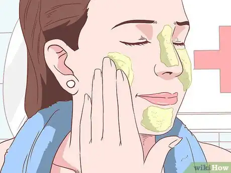 Image titled Get Rid of Acne Without Using Medication Step 20