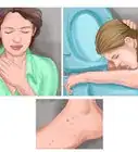 Reduce a Fever