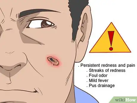 Image titled Heal Scabs on Your Face Step 8