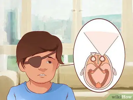 Image titled Get Rid of a Lazy Eye Step 11