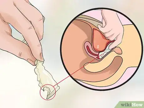 Image titled Remove a Condom Stuck Inside Step 5