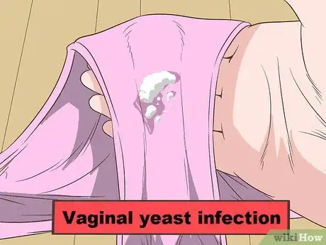 Image titled Tell if Vaginal Discharge Is Normal Step 14