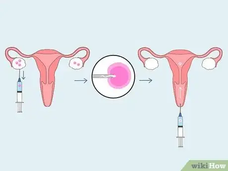 Image titled Detect Pregnancy if You Have PCOS Step 13