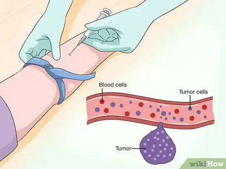 Image titled Detect Cancer with a Blood Test Step 6