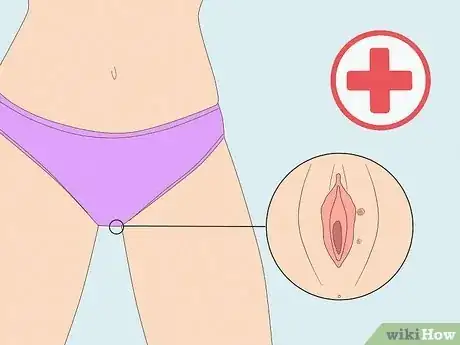 Image titled Stop Vaginal Itching Step 14