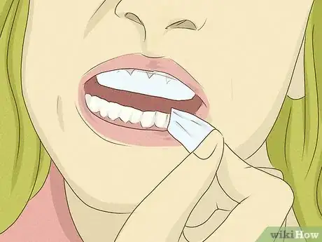 Image titled Get Whiter Teeth at Home Step 5