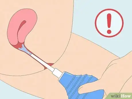 Image titled Stop Vaginal Itching Step 12