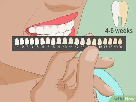 Image titled Protect Gums During Teeth Whitening Step 12