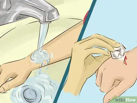 Image titled Stop Bleeding Step 1