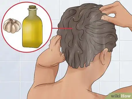 Image titled Use Garlic As a Hair Loss Remedy Step 8