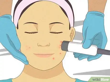 Image titled Get Rid of a Hard Pimple Step 17