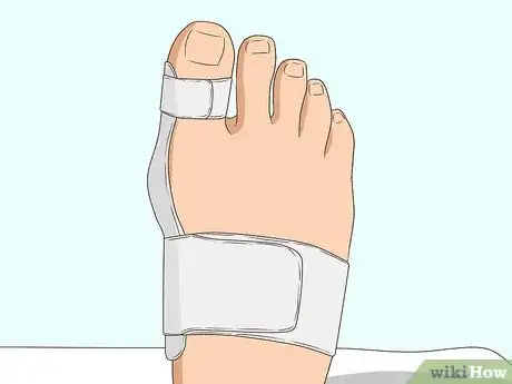 Image titled Stop a Bunion from Growing Step 8