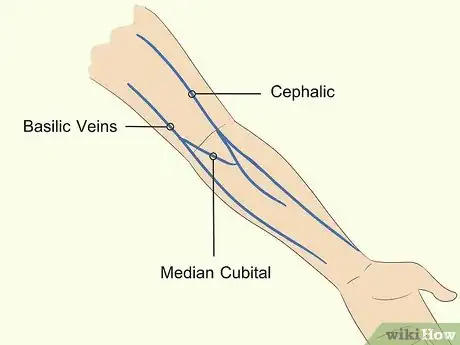 Image titled Troubleshoot a Difficult Venipuncture Step 11