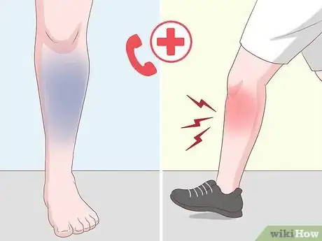 Image titled Get Rid of Leg Pain Step 16