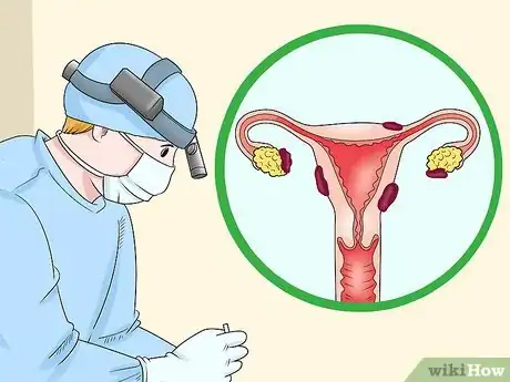 Image titled Protect Your Ovarian Reserve Step 4