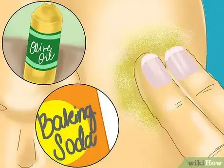 Image titled Use Olive Oil to Remove Scars Step 3