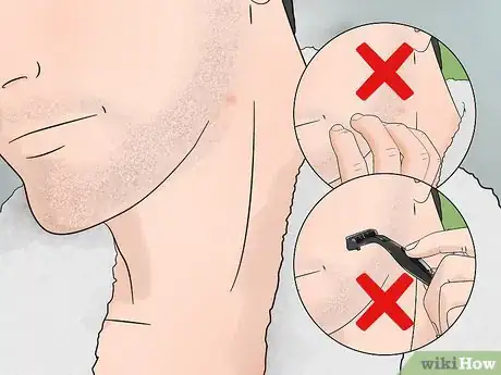 Image titled Stop Itching After Shaving Step 1