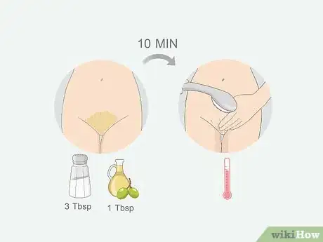 Image titled Get Rid of Ingrown Pubic Hair Step 7