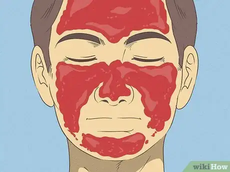 Image titled Make a Cleanser for Oily Skin Step 9