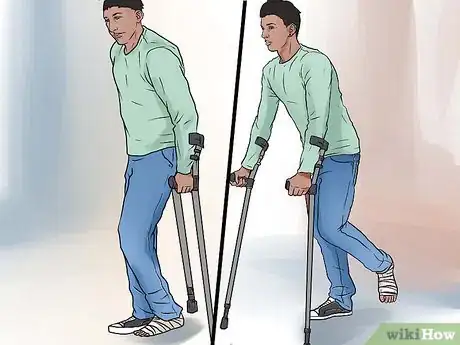 Image titled Walk on Crutches Step 15