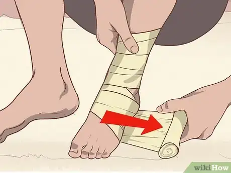 Image titled Relieve Plantar Fasciitis Pain Step 10