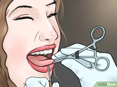 Image titled Hide a Tongue Piercing Step 1