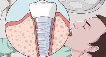 Treat Periodontal Disease