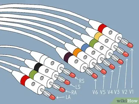 Image titled Put ECG Leads on a Chest Step 4