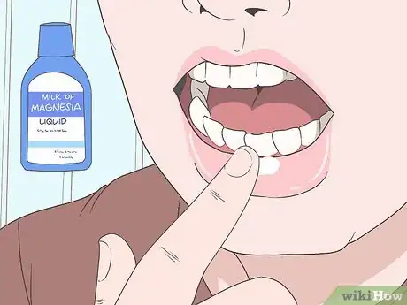 Image titled Treat Cold Sores Inside Your Mouth Step 3