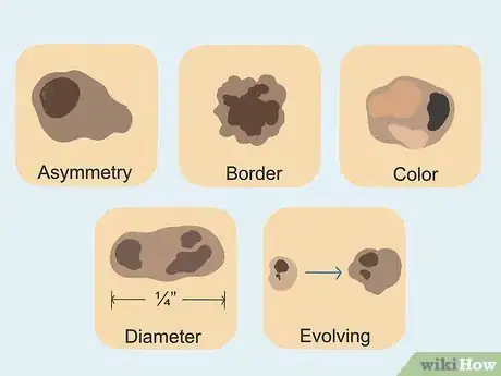 Image titled Get Rid of Moles on Your Face Step 4