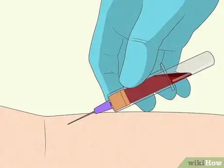 Image titled Treat Overmethylation Step 1