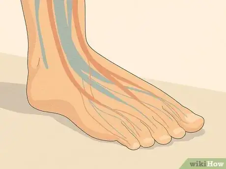 Image titled Know if You Have Neuropathy in Your Feet Step 1