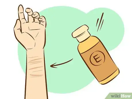 Image titled Get Rid of Self Harm Scars Step 10