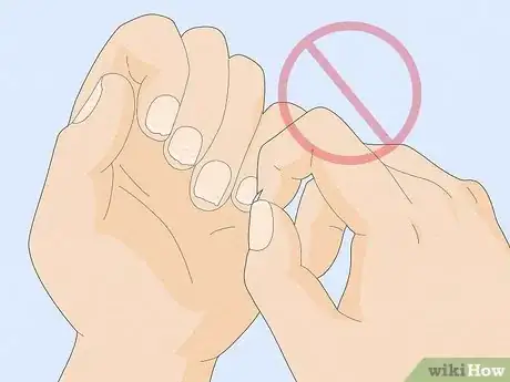 Image titled Get Rid of White Spots on Your Nails Step 9