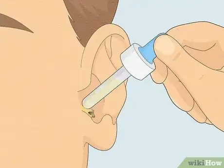 Image titled Get Something out of Your Ear Step 4