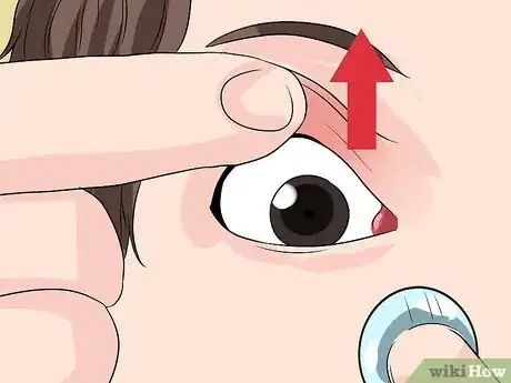 Image titled Remove Soft Contact Lenses After You Have Slept With Them Step 5