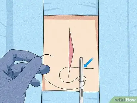 Image titled Perform an Instrument Tie Surgeon's Knot Step 13