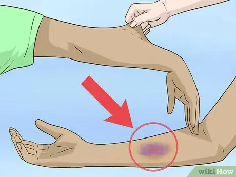 Image titled Know if You're Double Jointed Step 10