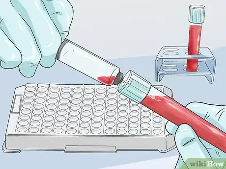 Image titled Diagnose Acromegaly Step 10