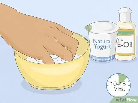 Image titled Get Rid of White Spots on Your Nails Step 5