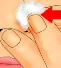 Remove Blackheads and Whiteheads with a Comedo Extractor