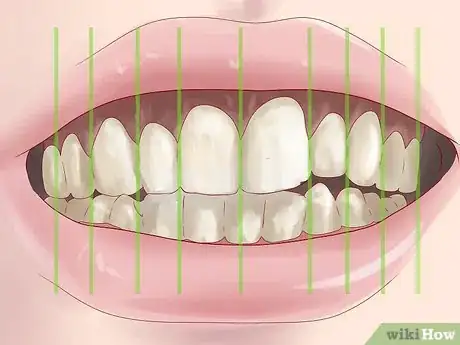 Image titled Tell if You Have Mouth Cancer Step 5