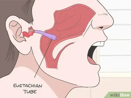 Image titled Unclog Your Ears After a Cold Step 1